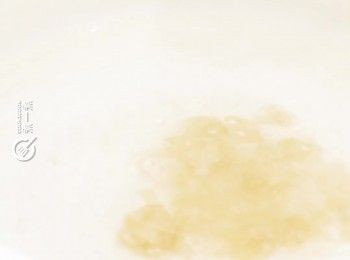 step10: 煲滾水，下冰糖煮融，下馬蹄片煮2分鐘
Boil water and rock sugar. Add in water chestnut and cook for 2 minutes.