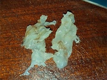 step2: 用刀拍扁