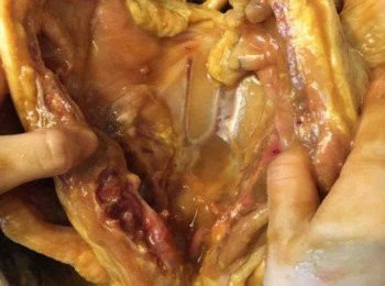 step1: 先把雞洗淨，記住拎去肺部和內臟。然後<a href="https://bit.ly/3EZL8dD" target="_blank" data-keyword="雞胸" class="guide-link"><strong>雞胸</strong></a> <span style="display:inline-block;vertical-align:middle;margin-top:-3px;color:initial;border-radius:3px;padding:2px 3px;font-size:12px;line-height:14px;background:#87d300;color:#fff;">即買</span> 開半