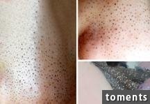 4大招讓黑頭永遠消失!毛孔變小了!粉刺痘痘通通不見了!太棒了一定要學起來!