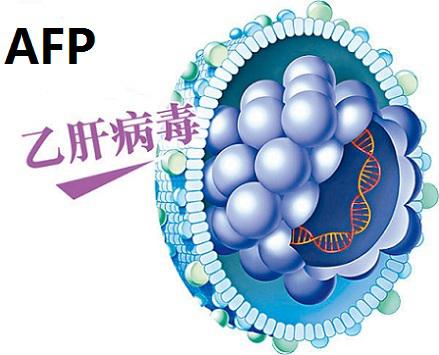 肝癌的危險因素和常見信號有哪些？如何排查早期肝癌？