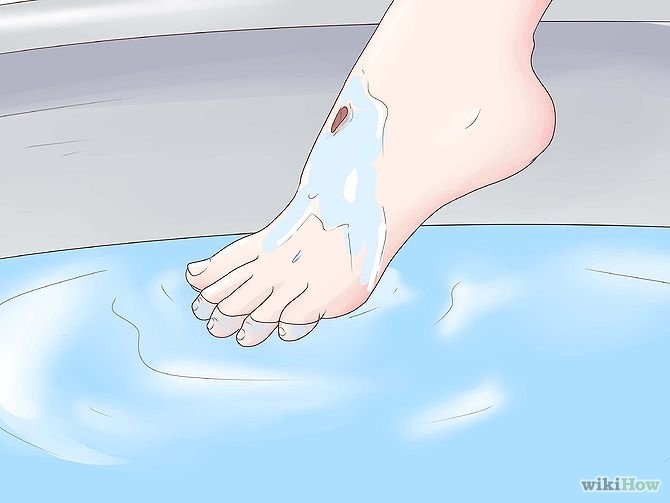 Get Rid of a Scab Step 8.jpg