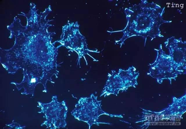 日本醫學專家提出殺死癌細胞新方法人人都能做到