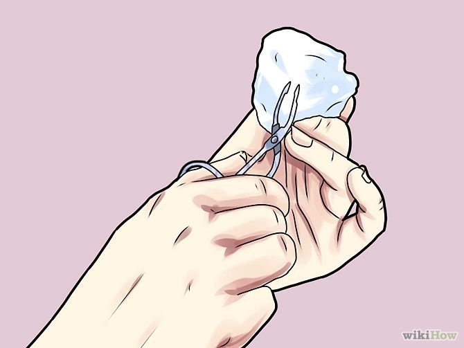 Remove a Skin Tag from Your Neck Step 5 Version 2.jpg