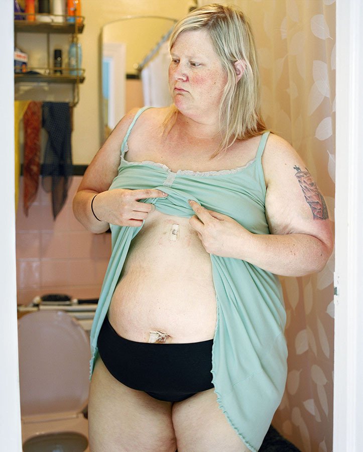 女胖子的逆襲：胖女孩自拍照片逼自己減重100斤| jiaren.org