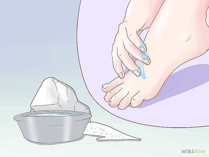 Get Rid of a Scab Step 13.jpg