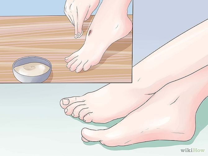 Get Rid of a Scab Step 16.jpg