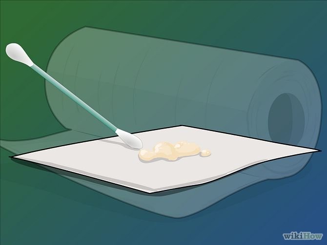 Image titled Remove Tonsil Stones (Tonsiliths) Step 6