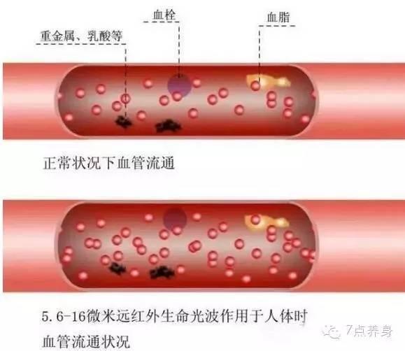 血管是如何一天天堵塞的，看完嚇一跳！