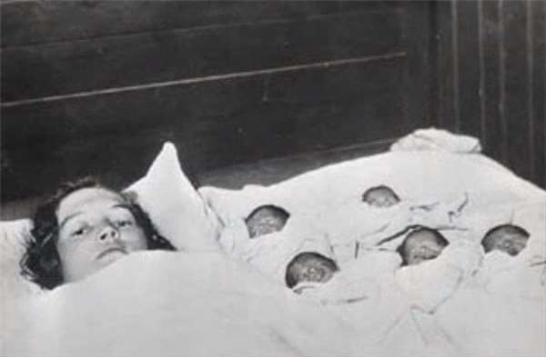 受人矚目的首例五胞胎女孩，最終卻是在籠子里長大的