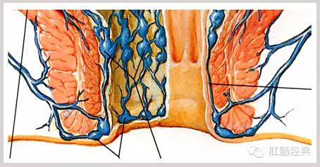百變痔瘡，圖說本質