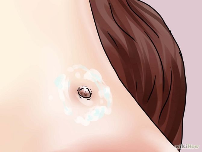 Remove a Skin Tag from Your Neck Step 4 Version 2.jpg