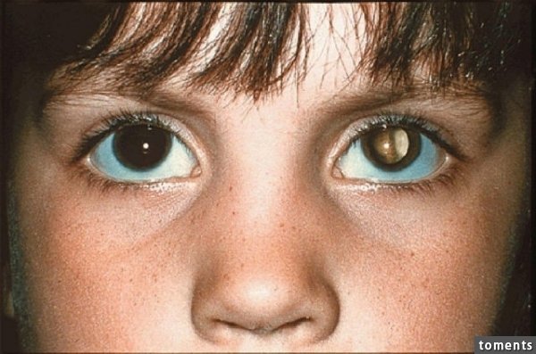 男性的尿液如果在測孕棒上顯示是兩條線的話，絕對不是懷孕了！趕快去看醫生吧～