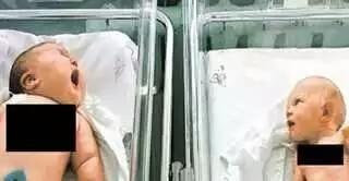 600斤孕婦產子，接生的13個醫生看到嬰兒驚呆了!